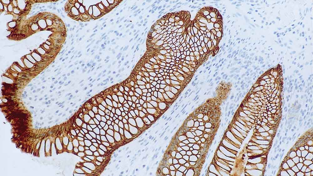 NCL-L-5D3,Cytokeratin 8/18,5D3 ,1mL 製品画像