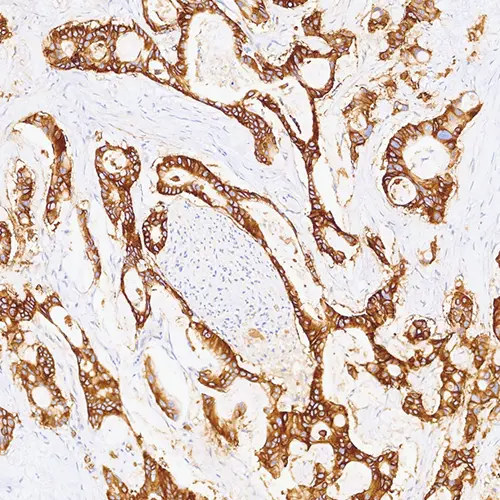 GLUT1 製品画像 Front View S