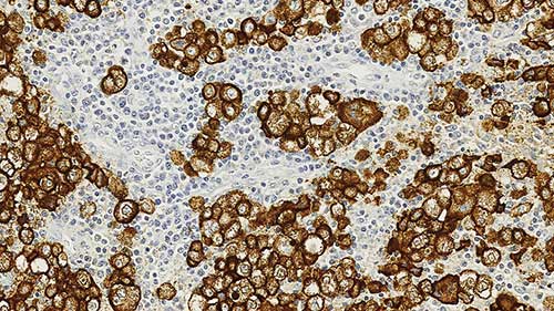 NCL-L-HMB45,Melanoma,HMB45,1mL 製品画像