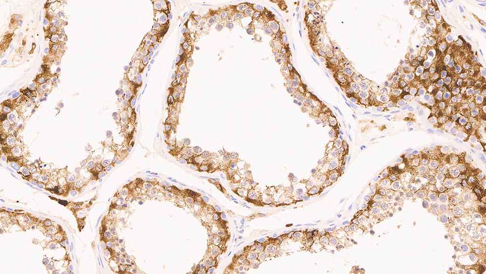NCL-L-InhibinA,Inhibin A,AMY82,1mL 製品画像