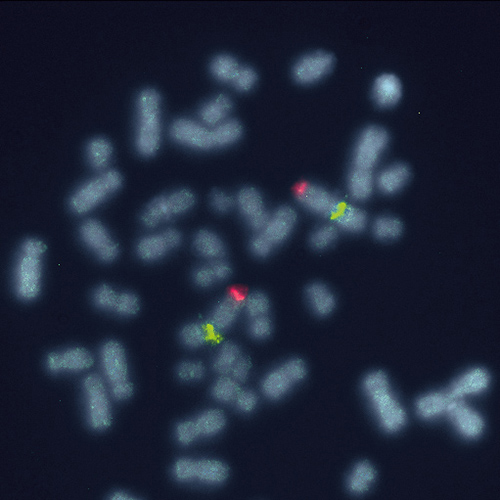 IVD 1q21/SRD 製品画像 Front View S