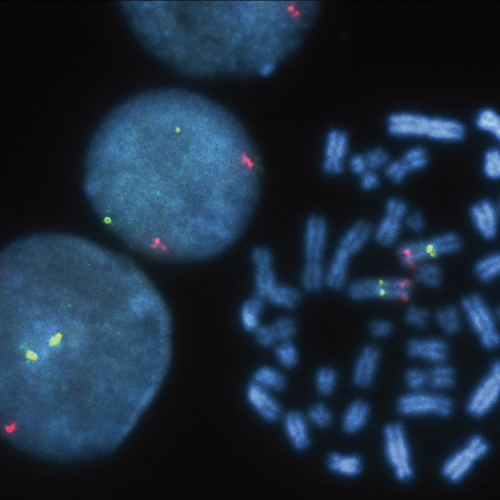 IVD TERC/3q11 製品画像 Front View S