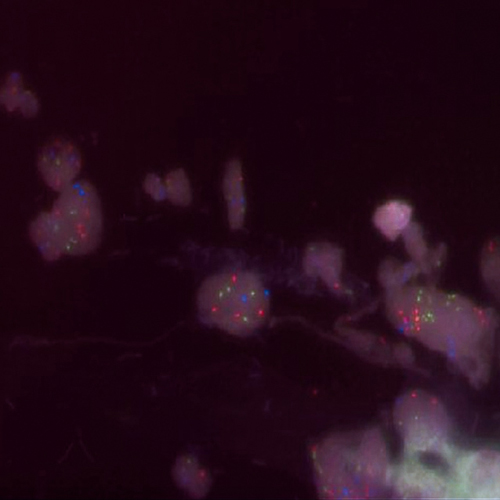 IVD TERC/MYC/SE 7 製品画像 Front View S