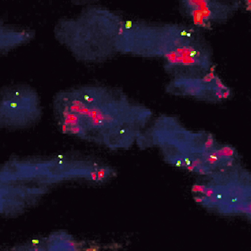 IVD CDK4/SE 12 製品画像 Front View S