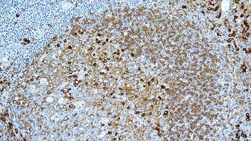 NCL-L-KAP-581,Kappa,CH15,1mL 製品画像