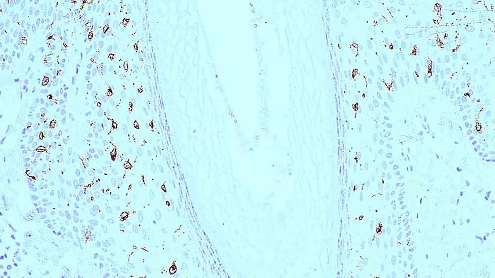 NCL-L-LANGERIN,Langerin,12D6,1mL 製品画像