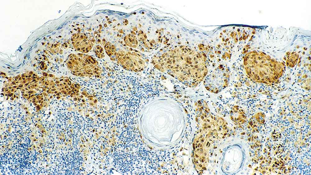 Microphthalmia Transcription Factor (MITF) 製品画像 Front View S