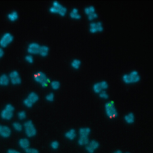 IVD NSD1/TERT 製品画像 Front View S