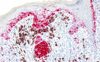 Bond Polymer Refine Red Detection Kit 製品画像