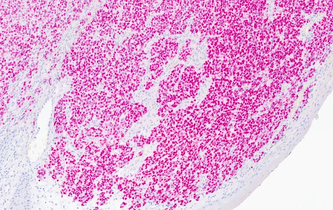 SOX10 - IHC Primary Antibodies 製品画像 Front View S