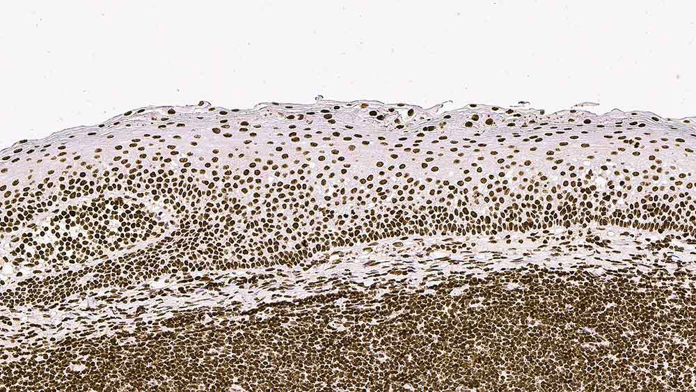 Topoisomerase I 製品画像 Front View S