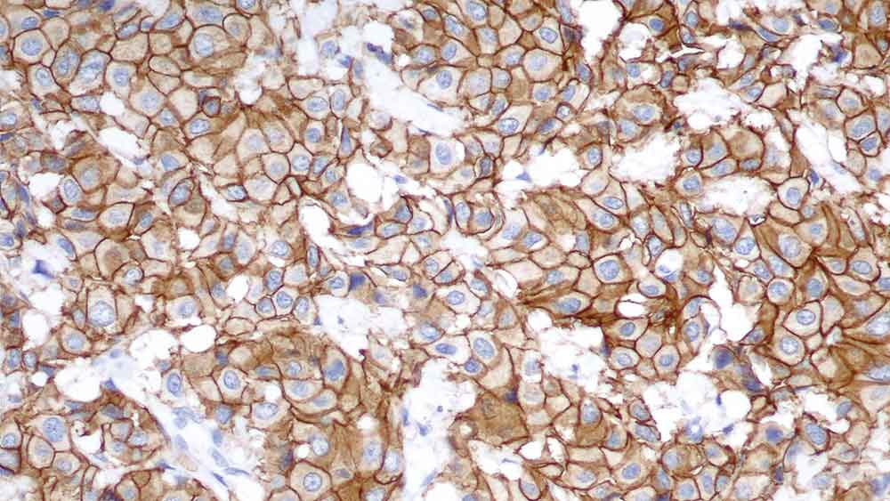 c-erbB-2 Oncoprotein (HER-2) 製品画像 Front View S
