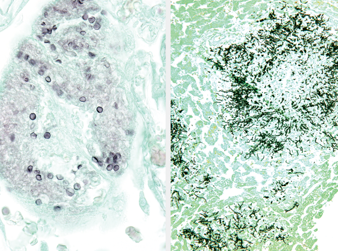 Modified GMS Silver Special Stain Kit 製品画像 Front View S