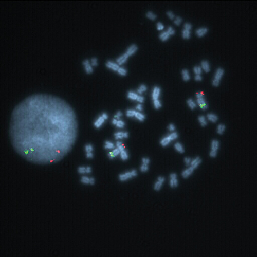 RUO - TERT / 5q31 product photo Front View S