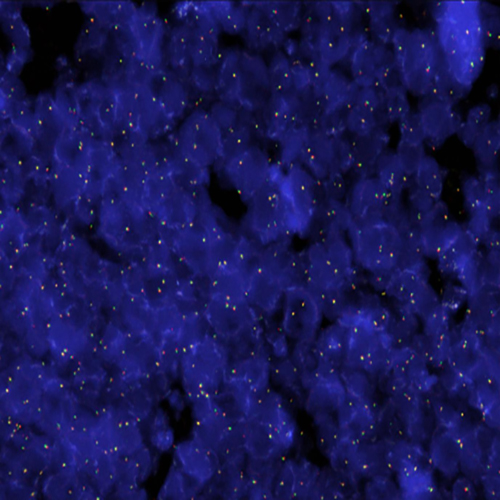 RUO - FGFR1 Break (8p11.2) product photo Front View S