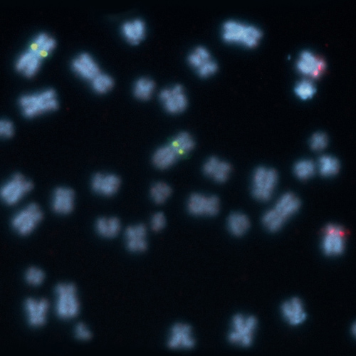 RUO - 1q21 / 8p21 (1q21 / 8p21) product photo Front View S