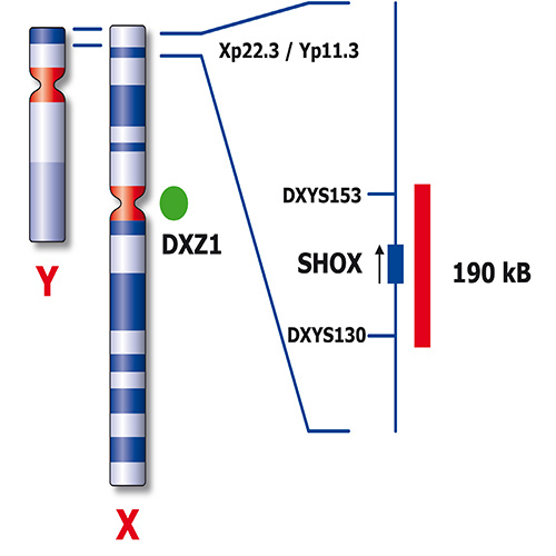 RUO - SHOX (Xp22) / SE X (DXZ1) product photo Back View S