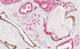 ChromoPlex 1 Dual Detection for BOND product photo Front View S