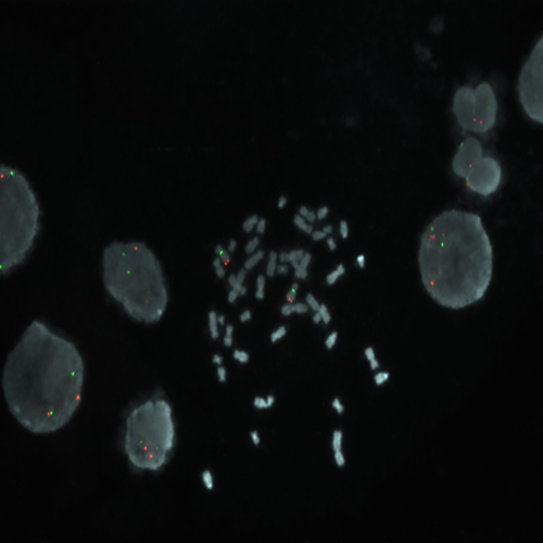 IVD MYC/SE 8 product photo Front View S