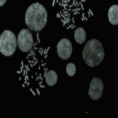 IVD CBFB Break product photo