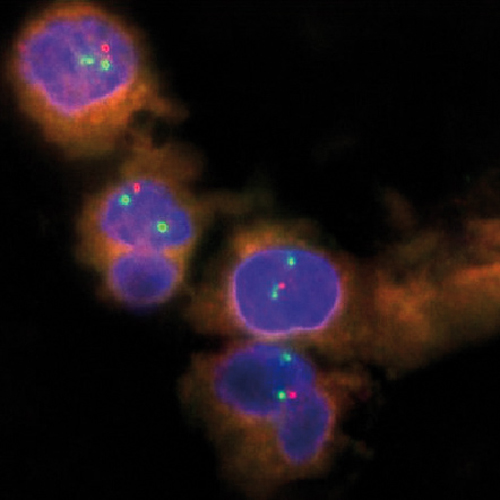 IVD DLEU1/13qter product photo Front View S