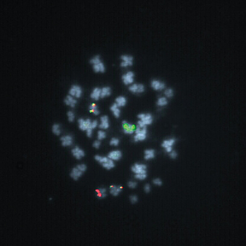 KMT2A/MLLT3 t(9;11) Fusion product photo