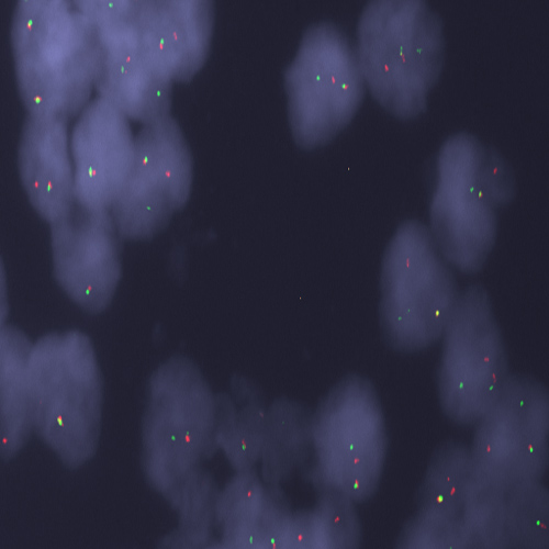 CCND1 (11q13) Break - XL for BOND product photo