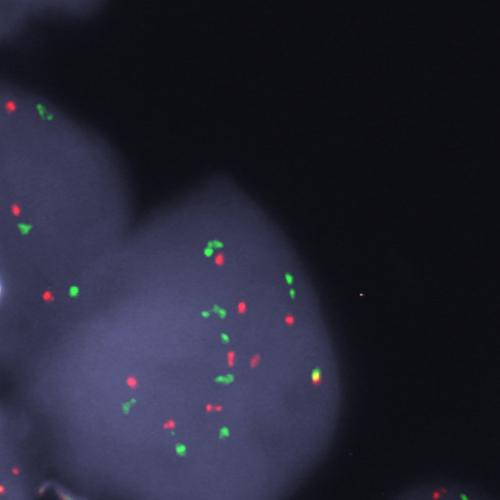 EGFR (7p11)/SE 7 (D7Z1) - XL for BOND product photo