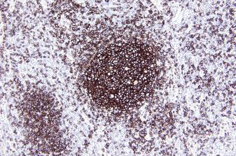 DAB Enhancer product photo Front View S