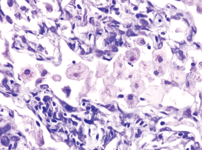 Acid Fast Bacillus Special Stain Kit product photo Front View S