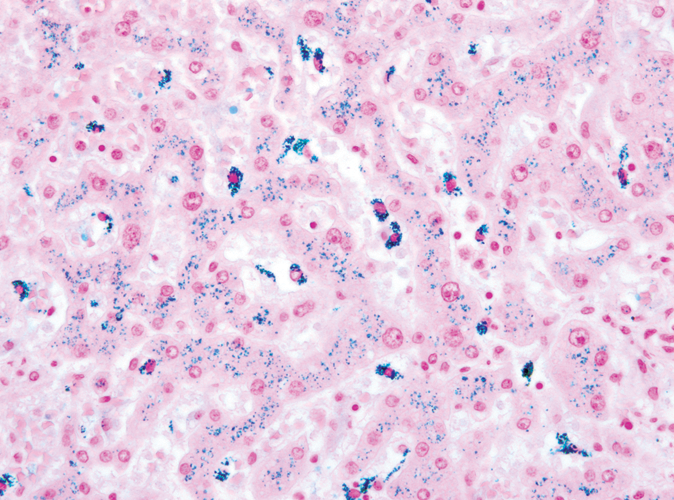 Perls' Prussian Blue Iron Special Stain Kit product photo Front View S