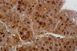 Arginase-1 (SP156) product photo