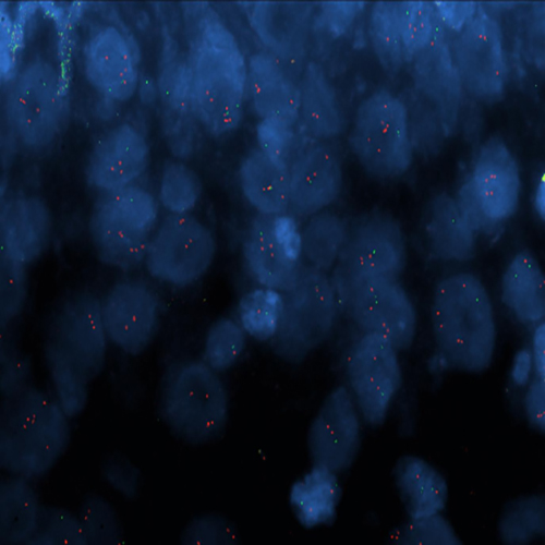TERT (5p15) / 5q31 (tissue) product photo