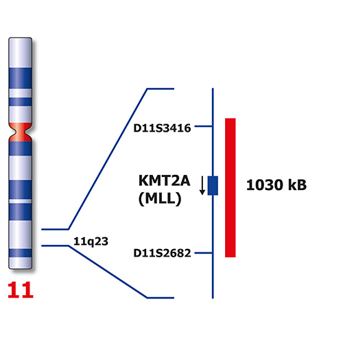 IVD KMT2A/MLLT3 product photo Side View S