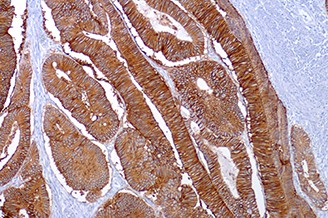 Ep-CAM/Epithelial Specific Antigen (MOC31) product photo