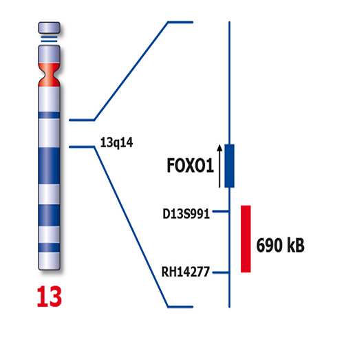 FOXO1 (13q14) - XL product photo
