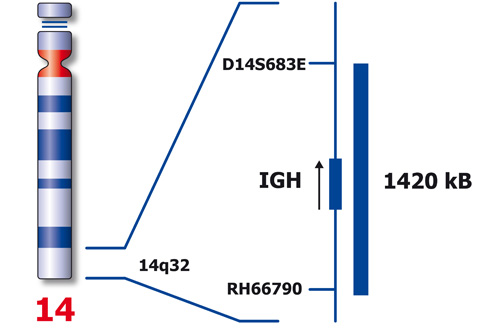 IGH (14q32) product photo Side View S