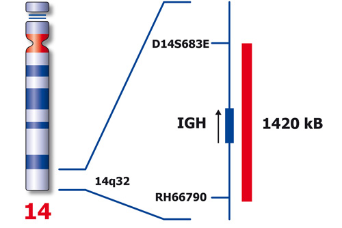 IGH (14q32) product photo