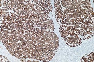 Hepatocyte Specific Antigen (Hep-Par1) (OCH1E5) product photo