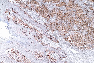 Microphthalmia Transcription Factor (MITF) (C5/D5) product photo