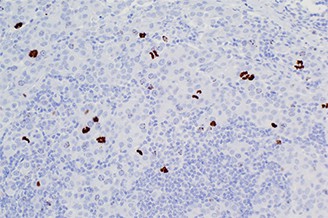 Phosphohistone H3 (PHH3) (Polyclonal) product photo