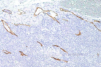 Podoplanin (D2-40) product photo