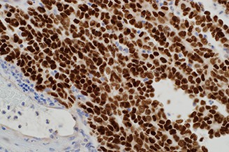 SOX-10 (Polyclonal) product photo