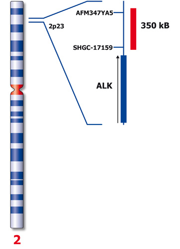 ALK (2p23) product photo Side View S