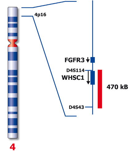 FGFR3 (4p16) product photo Side View S