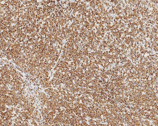 Bcl-2 Oncoprotein product photo