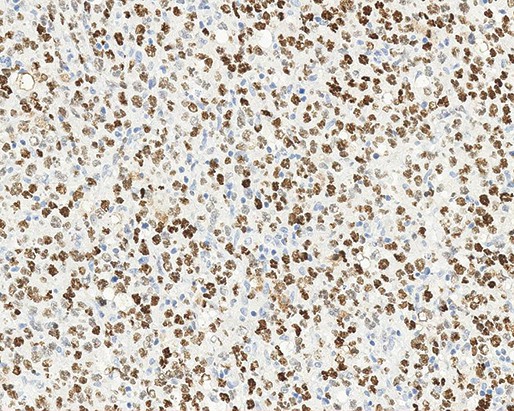 Bcl-6 Oncoprotein product photo