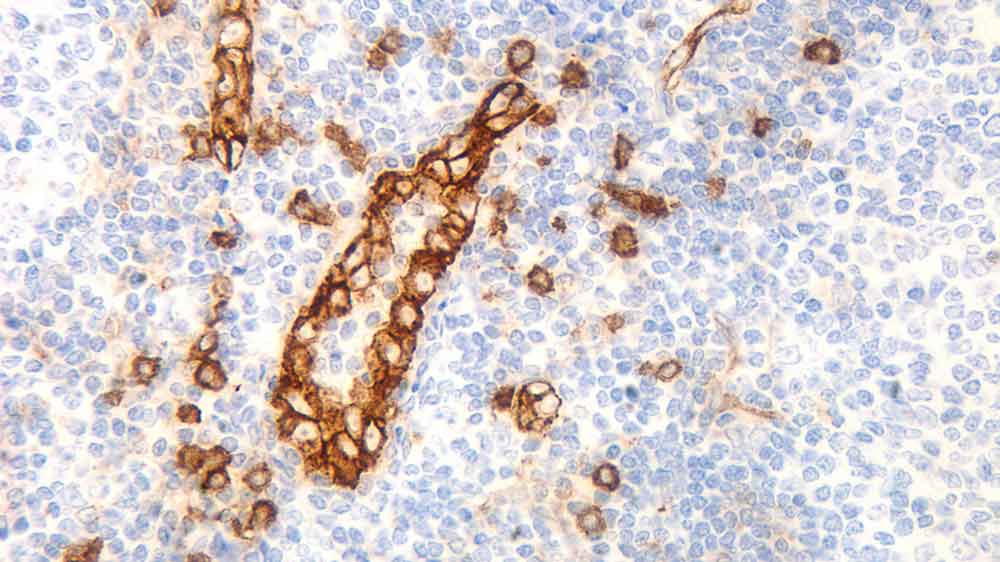 1ml NCL-L-CD123 product photo