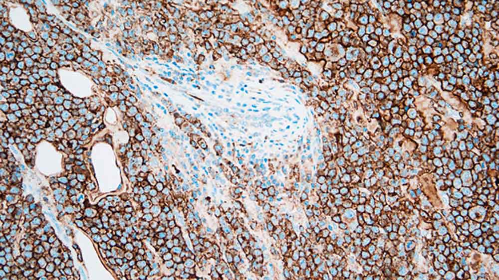 7ml CD138 Bond RTU Primary product photo