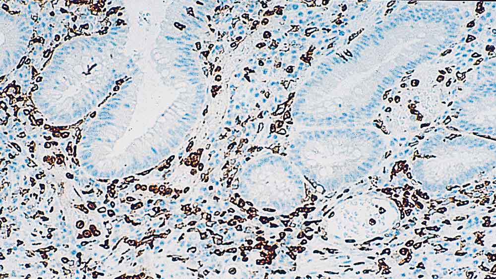 1ml NCL-L-CD16 product photo